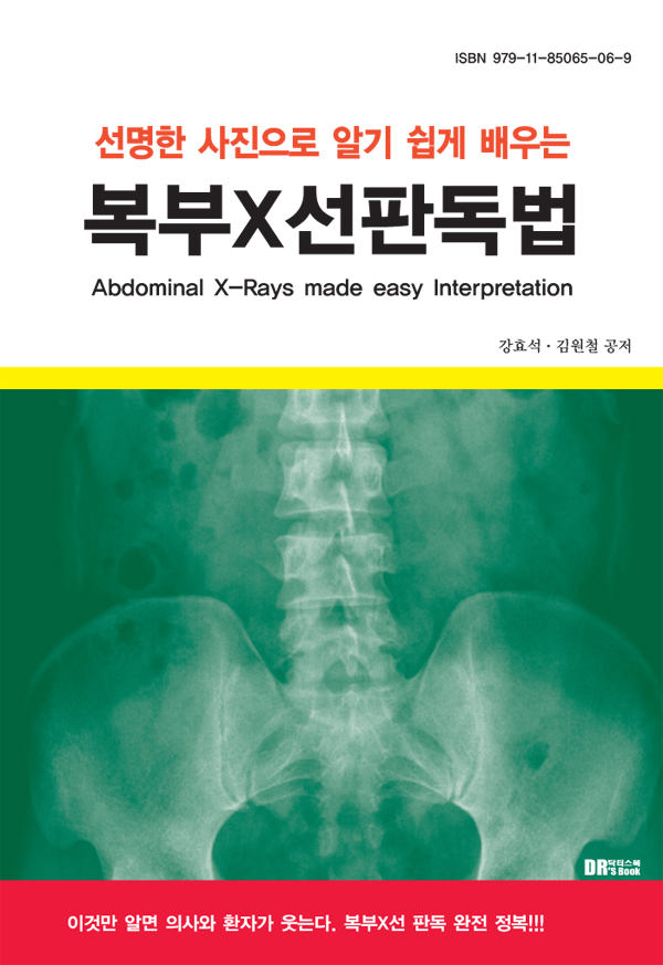 선명한 사진으로 알기 쉽게 배우는 복부X선판독법