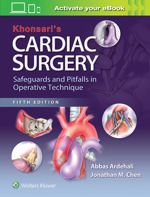 Khonsari's Cardiac Surgery: Safeguards and Pitfalls in Operative Technique-5판(2016.09)
