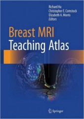 Breast MRI Teaching Atlas
