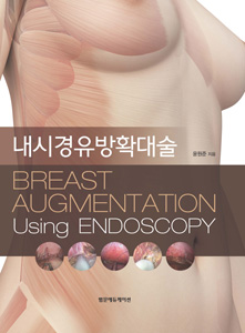 내시경유방확대술
