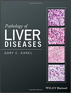 Pathology of Liver Diseases