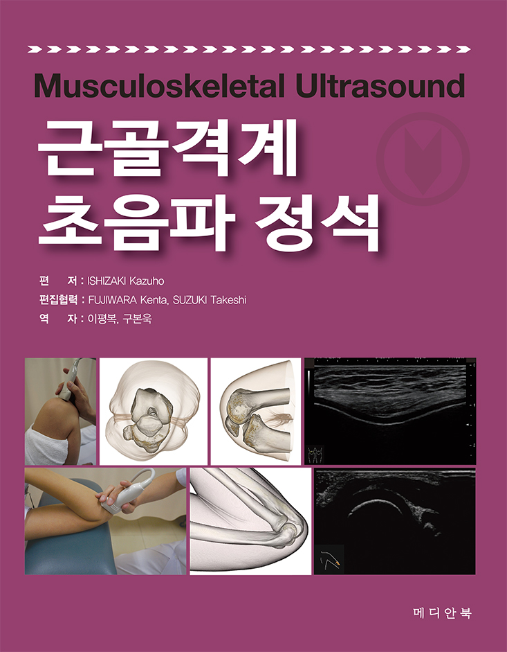 근골격계 초음파정석