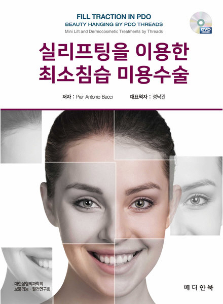 실리프팅을 이용한 최소침습 미용수술(FILL TRACTION IN PDO)