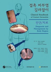 접촉피부염 길라잡이 진단 및 치료