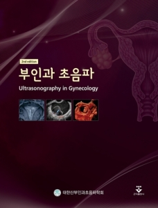 부인과초음파-2판