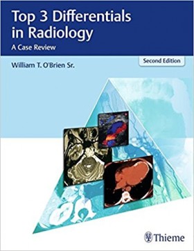 Top 3 Differentials in Radiology A Case Review-2판