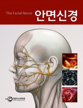 안면신경