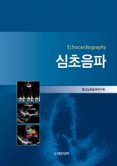 심초음파