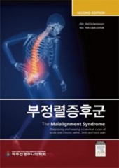 부정렬증후근