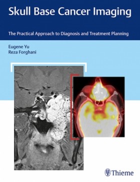 Skull Base Cancer Imaging: The Practical Approach to Diagnosis and Treatment Planning-1판