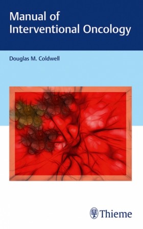 Manual of Interventional Oncology-1판