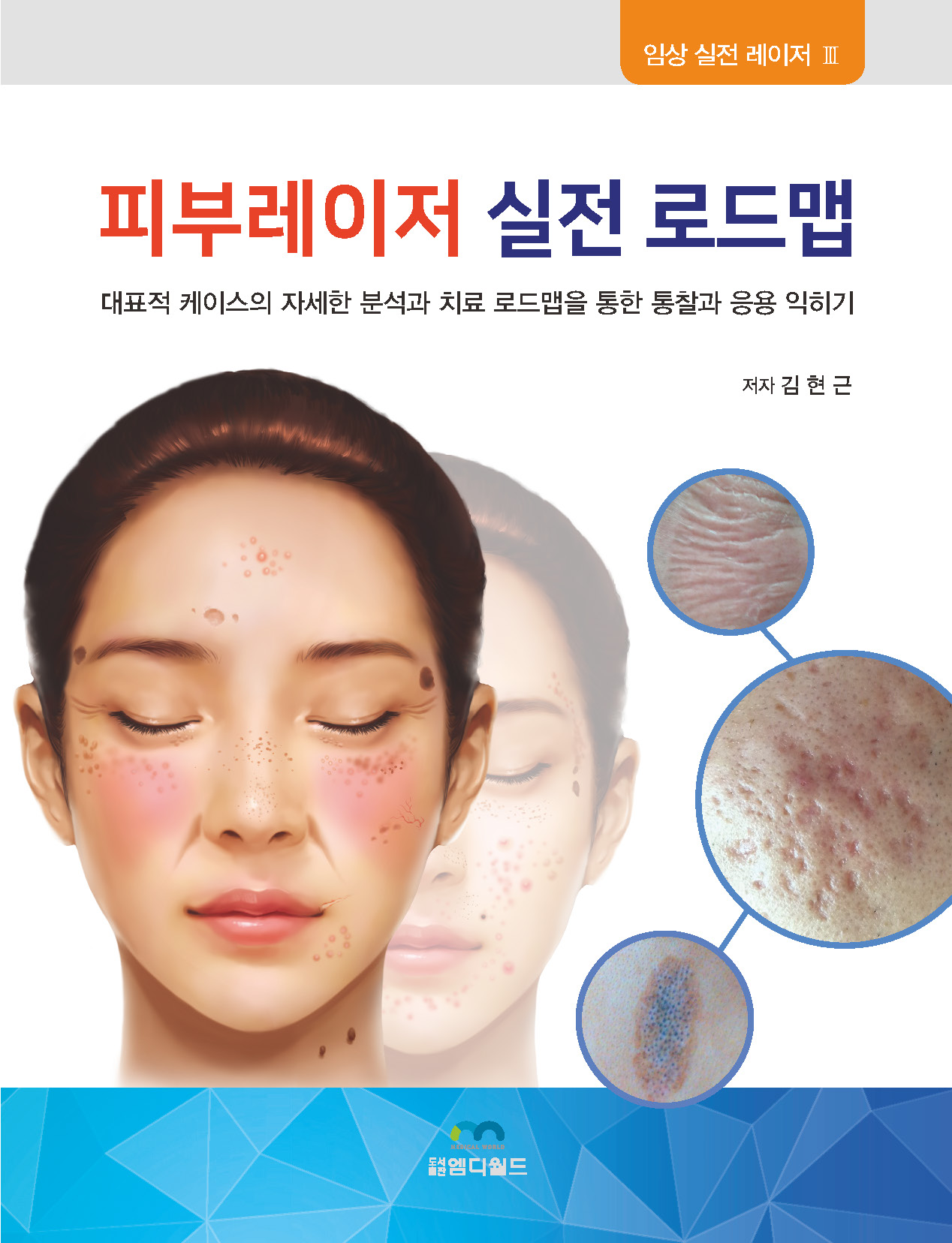 피부레이저 실전 로드맵