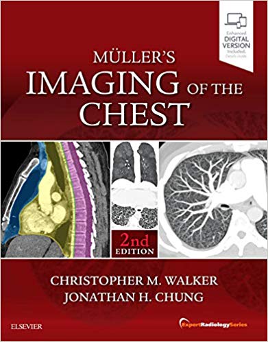 Muller's Imaging of the Chest-2판