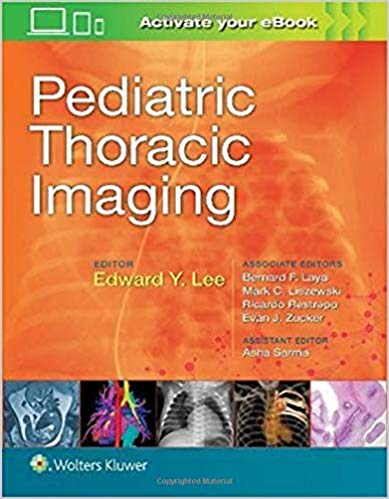 Pediatric Thoracic Imaging-1판