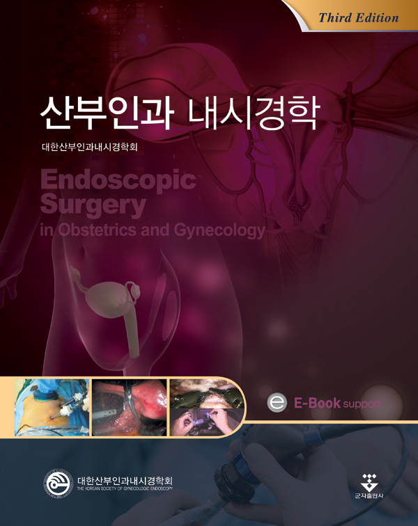 산부인과내시경학-3판