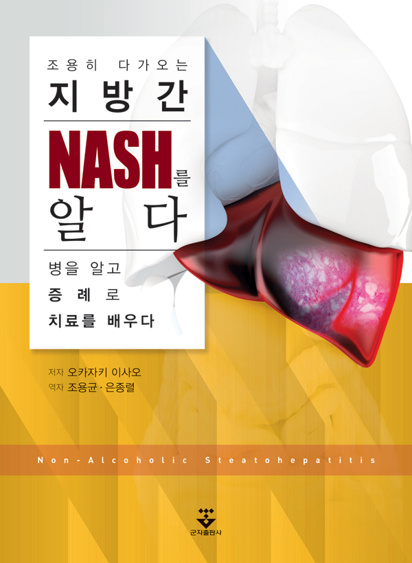 조용히 다가오는 지방간and#8211;NASH를 알다