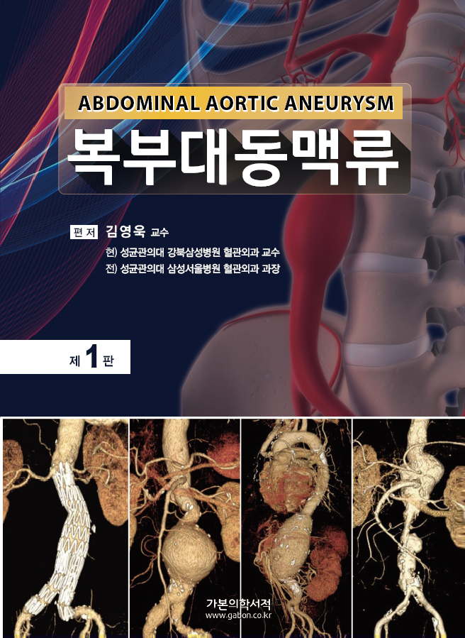 복부대동맥류-1판