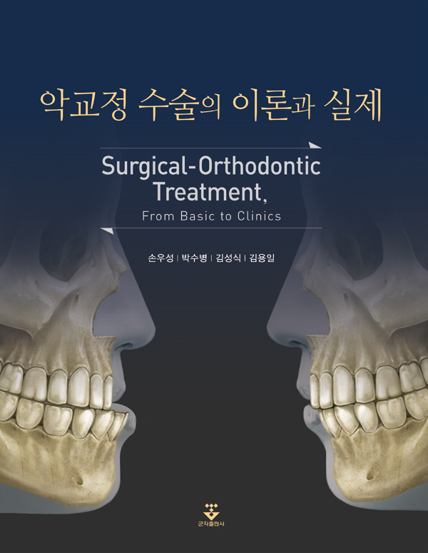 악교정수술의 이론과 실제