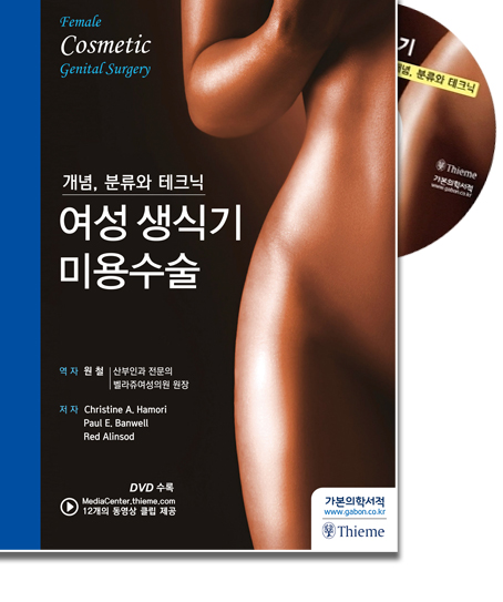 여성생식기 미용수술