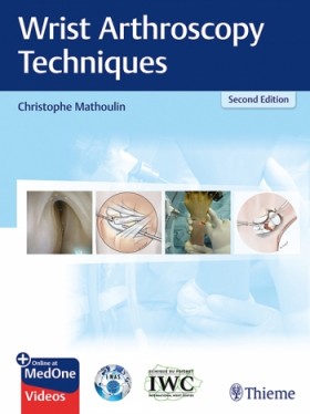 Wrist Arthroscopy Techniques-2판