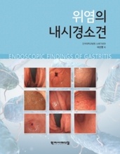 위염의 내시경소견