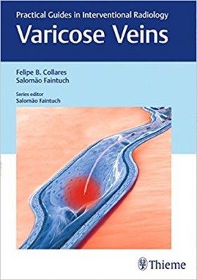 Varicose Veins-1판