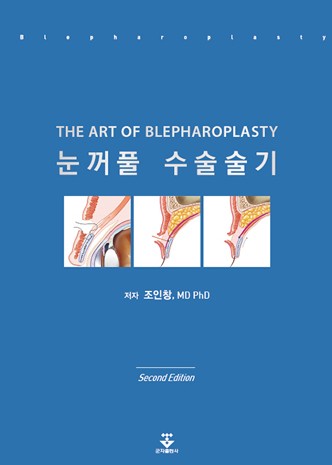 눈꺼풀수술술기-2판