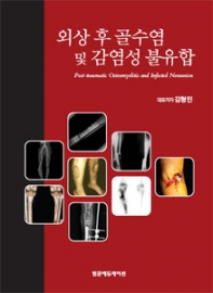 외상 후 골수염 및 감염성 불유합
