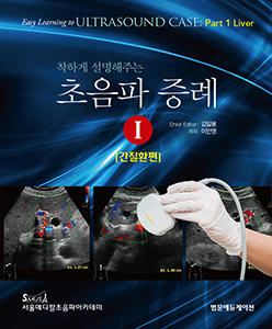 착하게 설명해주는 초음파증례 I-간질환편