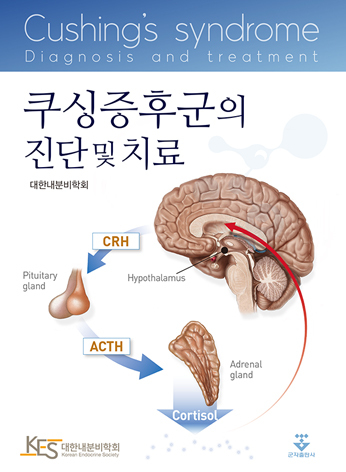 쿠싱증후군의 진단 및 치료-1판