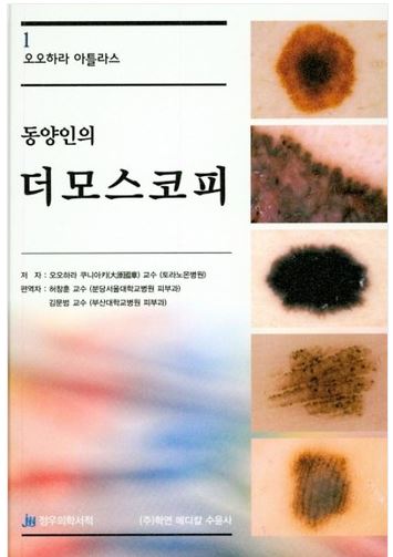 동양인의 더모스코피-1판