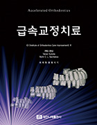 급속교정치료