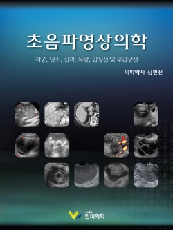 초음파영상의학: 자궁 난소 산과 유방 갑상선 및 부갑상선 (분권 III)