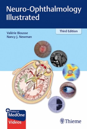 Neuro-Ophthalmology Illustrated-3판