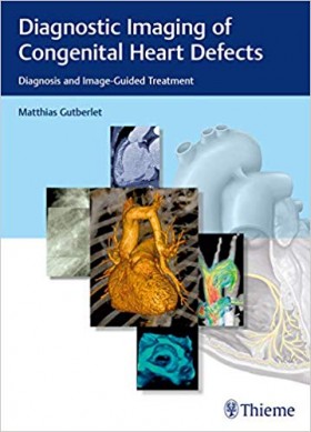 Diagnostic Imaging of Congenital Heart Defects