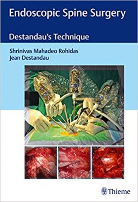 Endoscopic Spine Surgery Destandau's Technique