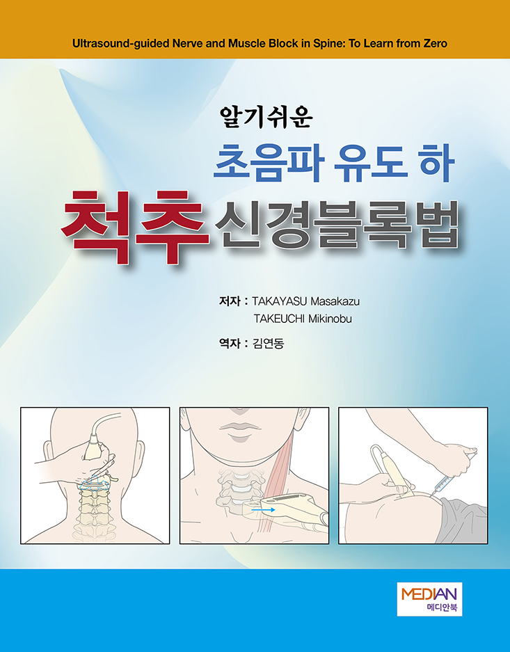 알기쉬운 초음파 유도하 척추신경블록법