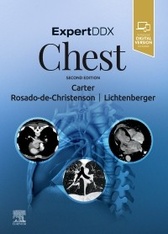 ExpertDDx: Chest-2판