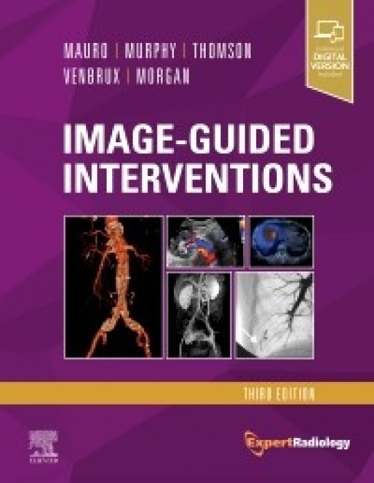 Image-Guided Interventions-3판