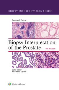 Biopsy Interpretation of the Prostate-6판