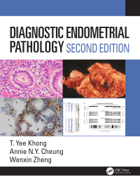 Diagnostic Endometrial Pathology-2판