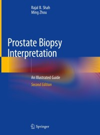 Prostate Biopsy Interpretation-2판(Hardcover)