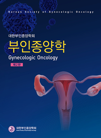 부인종양학-2판