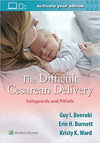 The Difficult Cesarean Delivery-1판