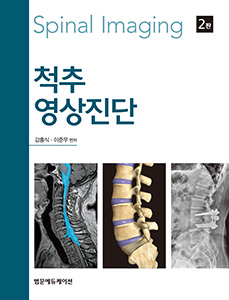 척추영상진단-2판