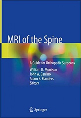 MRI of the Spine(Hardcover)