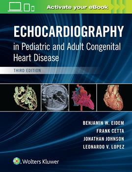 Echocardiography in Pediatric-3판