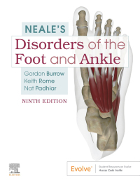 Neale'S Disorders Of The Foot And Ankle-9판