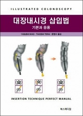 대장내시경삽입법 기본과 응용