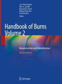 Handbook of Burns Volume 2-2판(Hardcover)